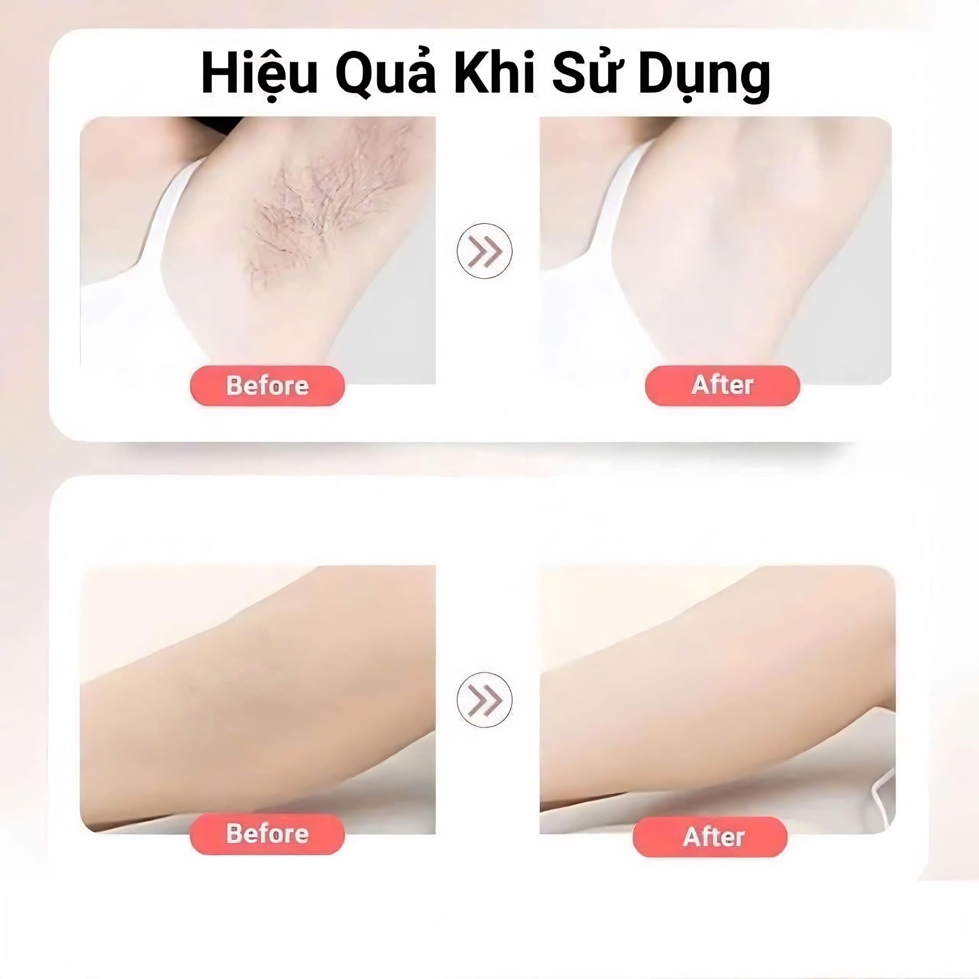 Combo Làm Mềm Da Balea - Giải Pháp Tẩy Lông Và Dưỡng Phục Hồi Toàn Diện