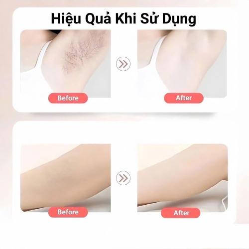 Combo Làm Mềm Da Balea - Giải Pháp Tẩy Lông Và Dưỡng Phục Hồi Toàn Diện